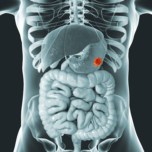 Gastrointestinal Oncology
