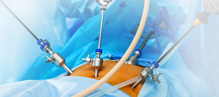 Laparoscopic Surgery